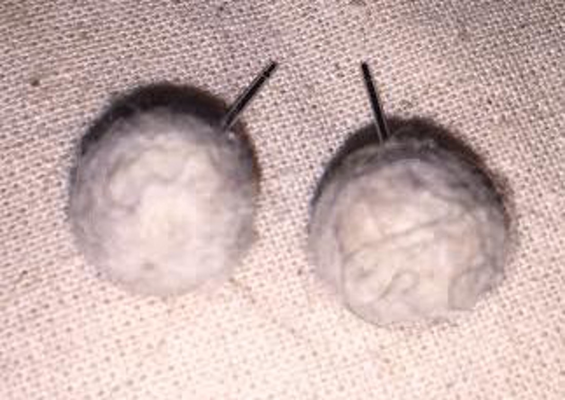 Cercei cu buton Berry, 4 perechi - - Artynos.ro Cercei cu buton Berry, 4 perechi - - Artynos.ro